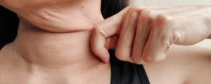 Woman with underactive thyroid in london at Jonathan Hughes ENT