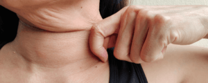 Woman with underactive thyroid in london